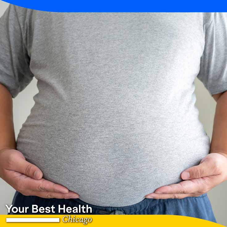 Beer bellies: Why they are unhealthy and how to make changes
