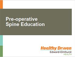 preoperative-spine-education