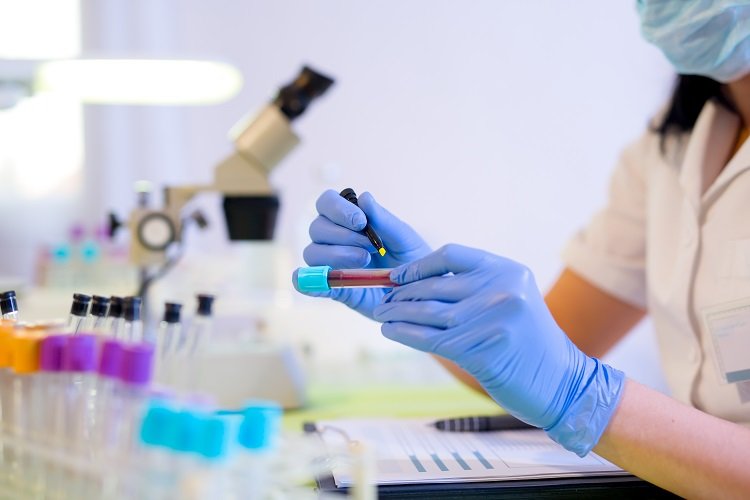 Blood Cancer Signs - What Are The Signs?
