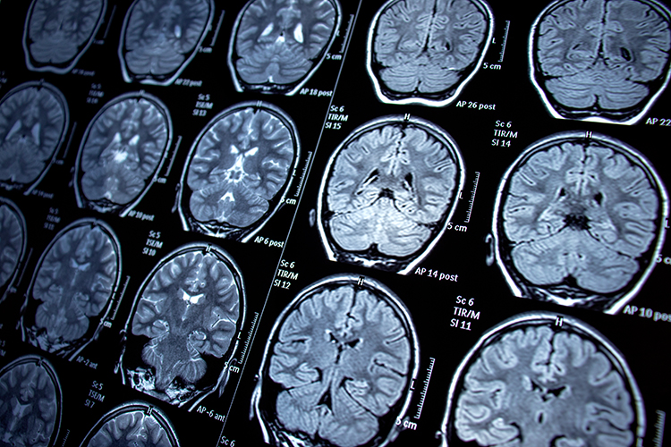 Brain scan images 750x500