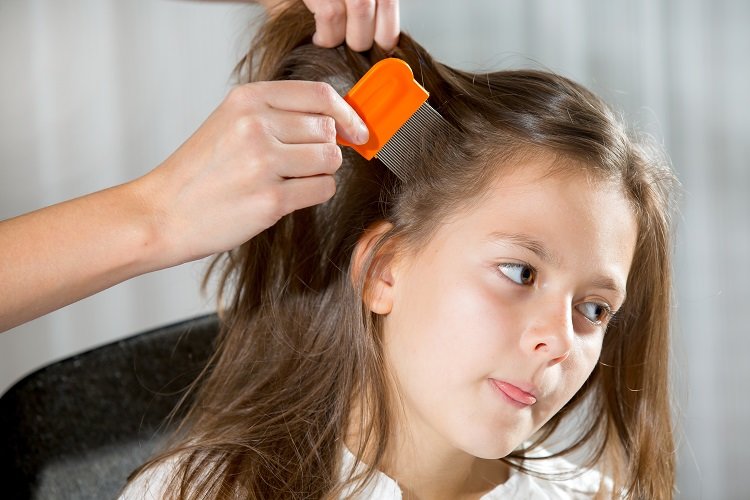 What parents should know about head lice | Edward-Elmhurst Health